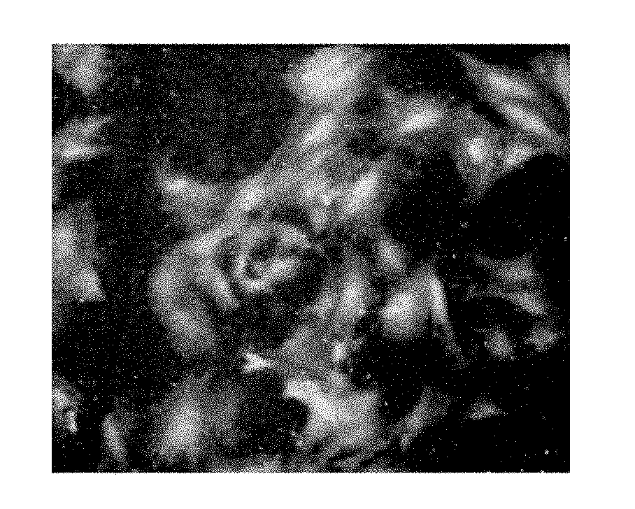 Preparation method of nano magnetic particles for detection and treatment of coronary heart diseases