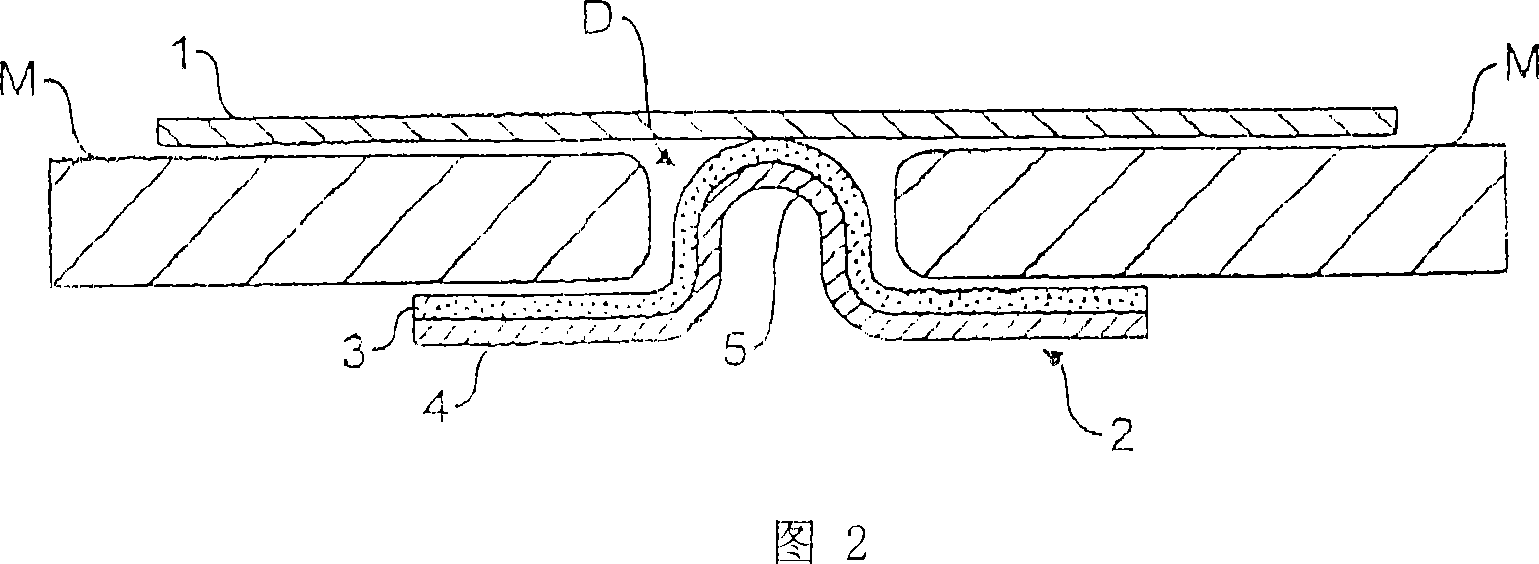 Repair thing of umbilical hernia or umbilical side hernia