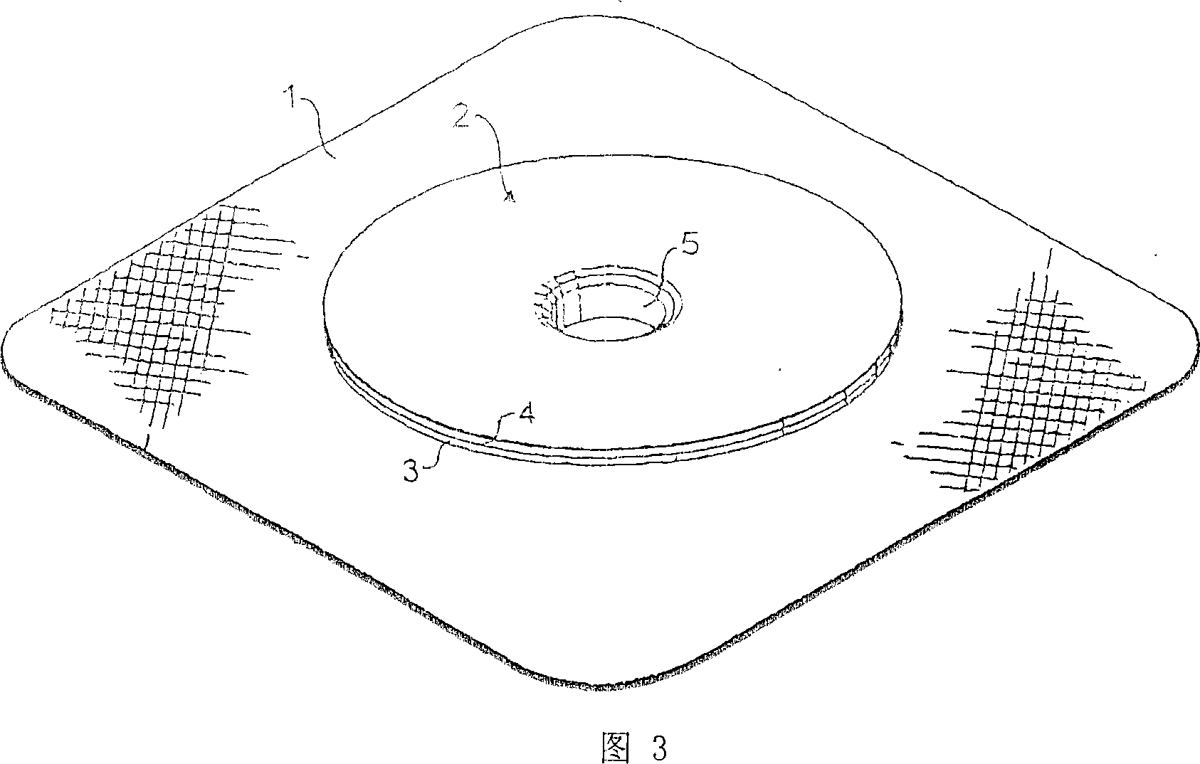 Repair thing of umbilical hernia or umbilical side hernia