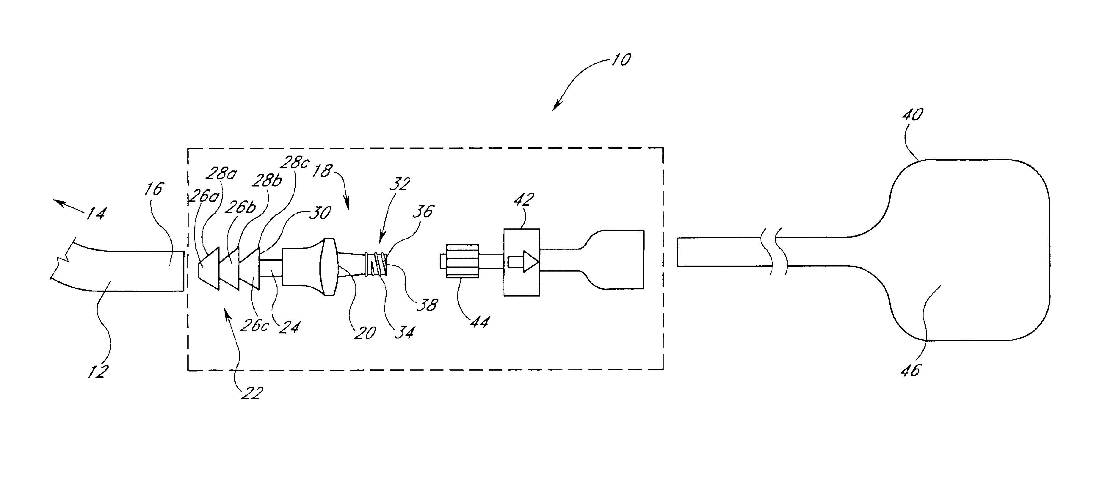 Urinary catheter system with a releasable connector