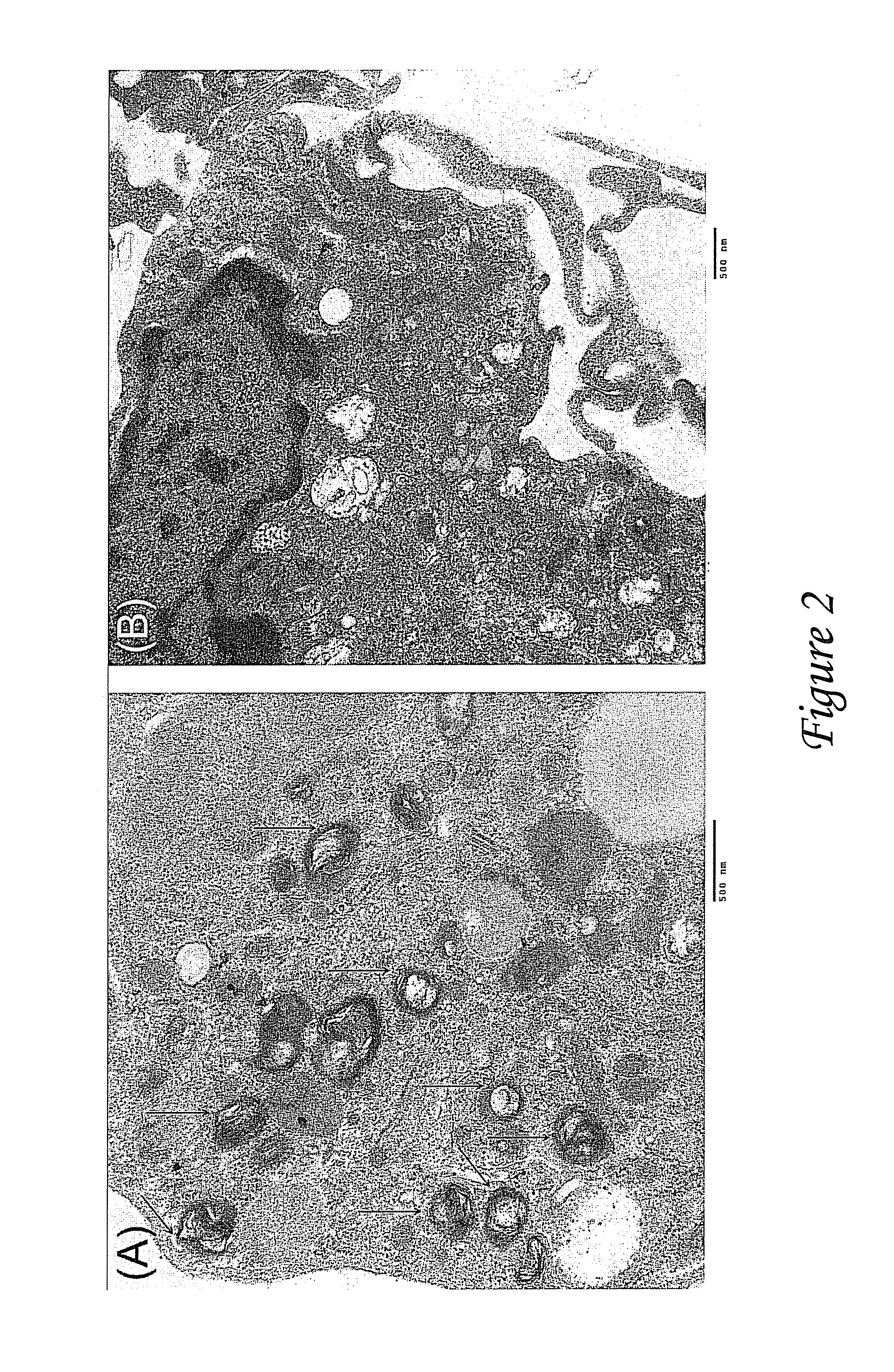 Nanoparticles and methods of use