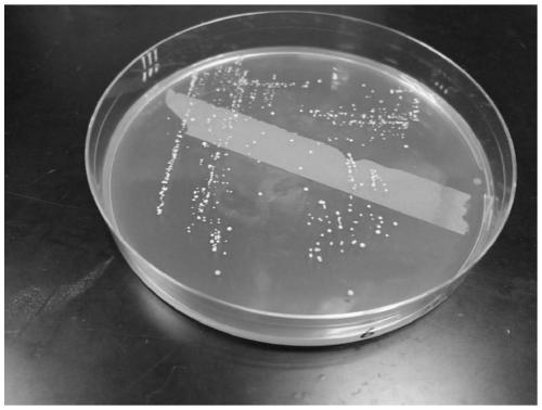 Bifidobacterium pseudocatenulatum CCFM1047, composition, fermented food, application and bacterial agent of bifidobacterium pseudocatenulatum CCFM1047 and preparation method of bacterial agent of bifidobacterium pseudocatenulatum CCFM1047