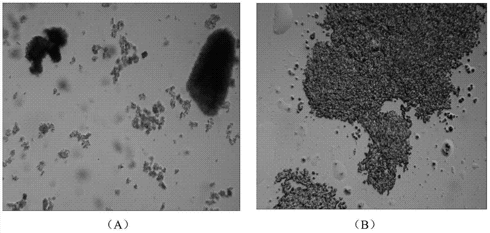 Preparation method and application of insulin detemir crystal