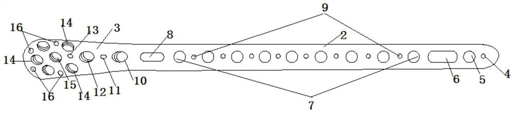 Tibia far-end inner side bone fracture plate