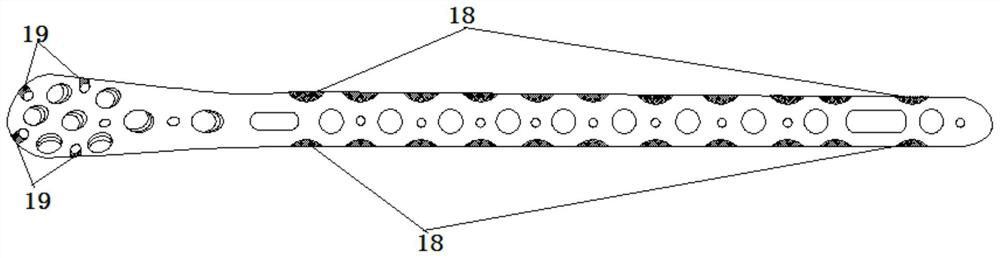 Tibia far-end inner side bone fracture plate