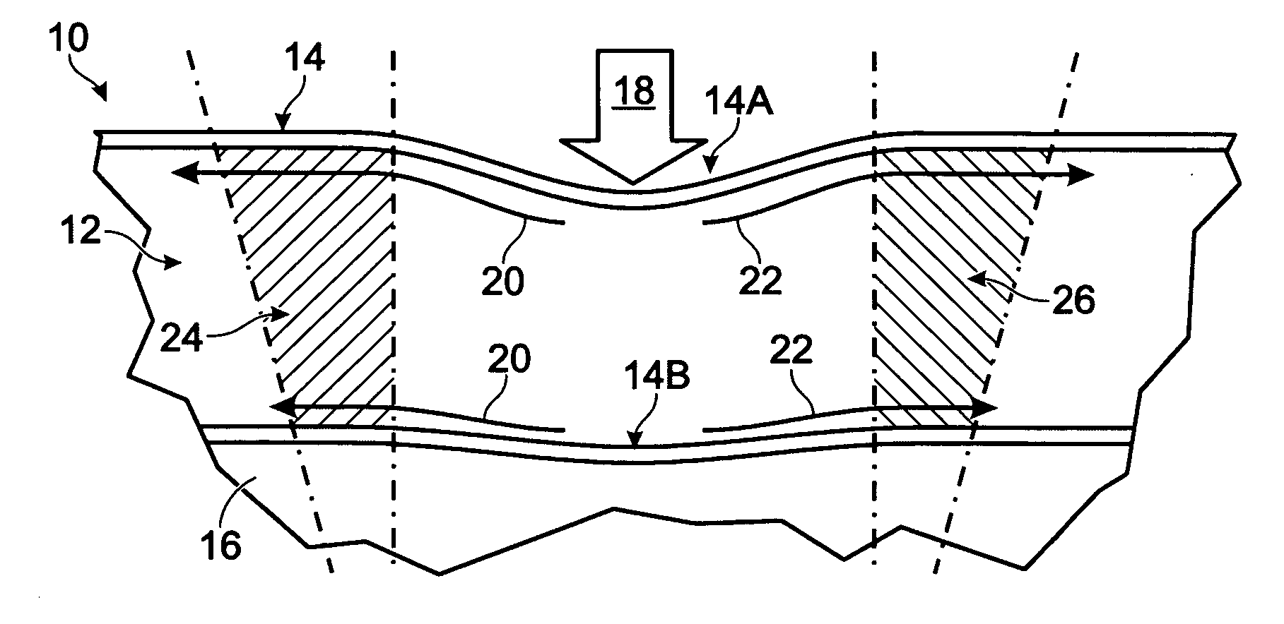 Anatomical, pressure-evenizing mattress overlay