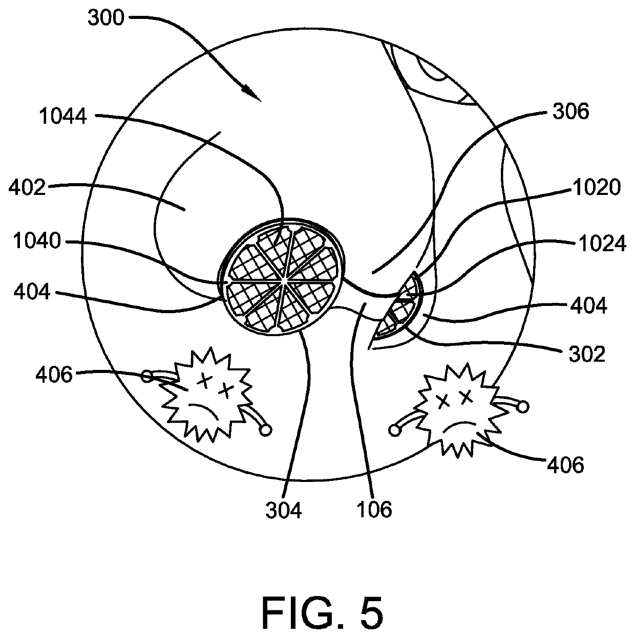 Nose Filtering Device