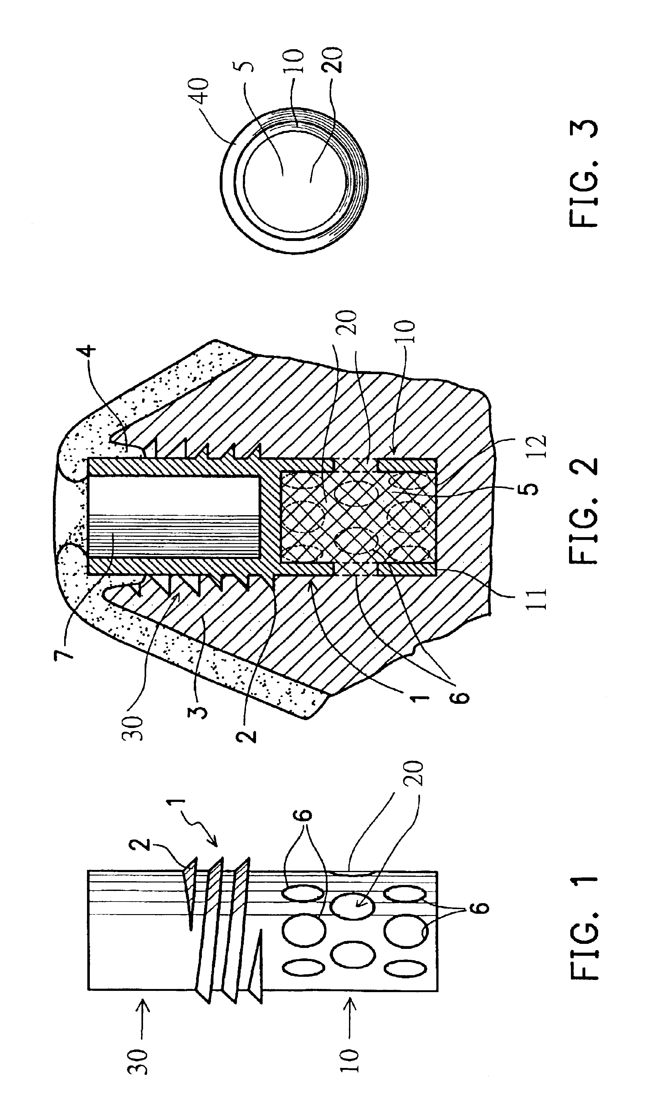 Dental implant with hardened calcium phosphate cement inside