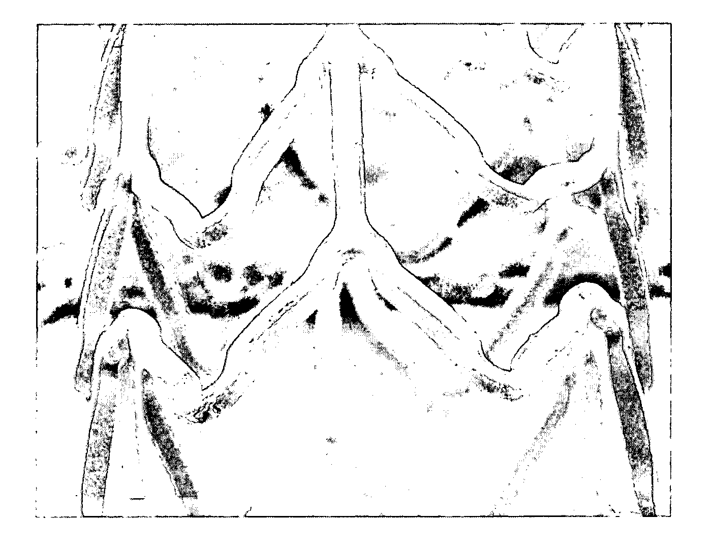 Coatings for implantable medical devices comprising hydrophilic substances and methods for fabricating the same