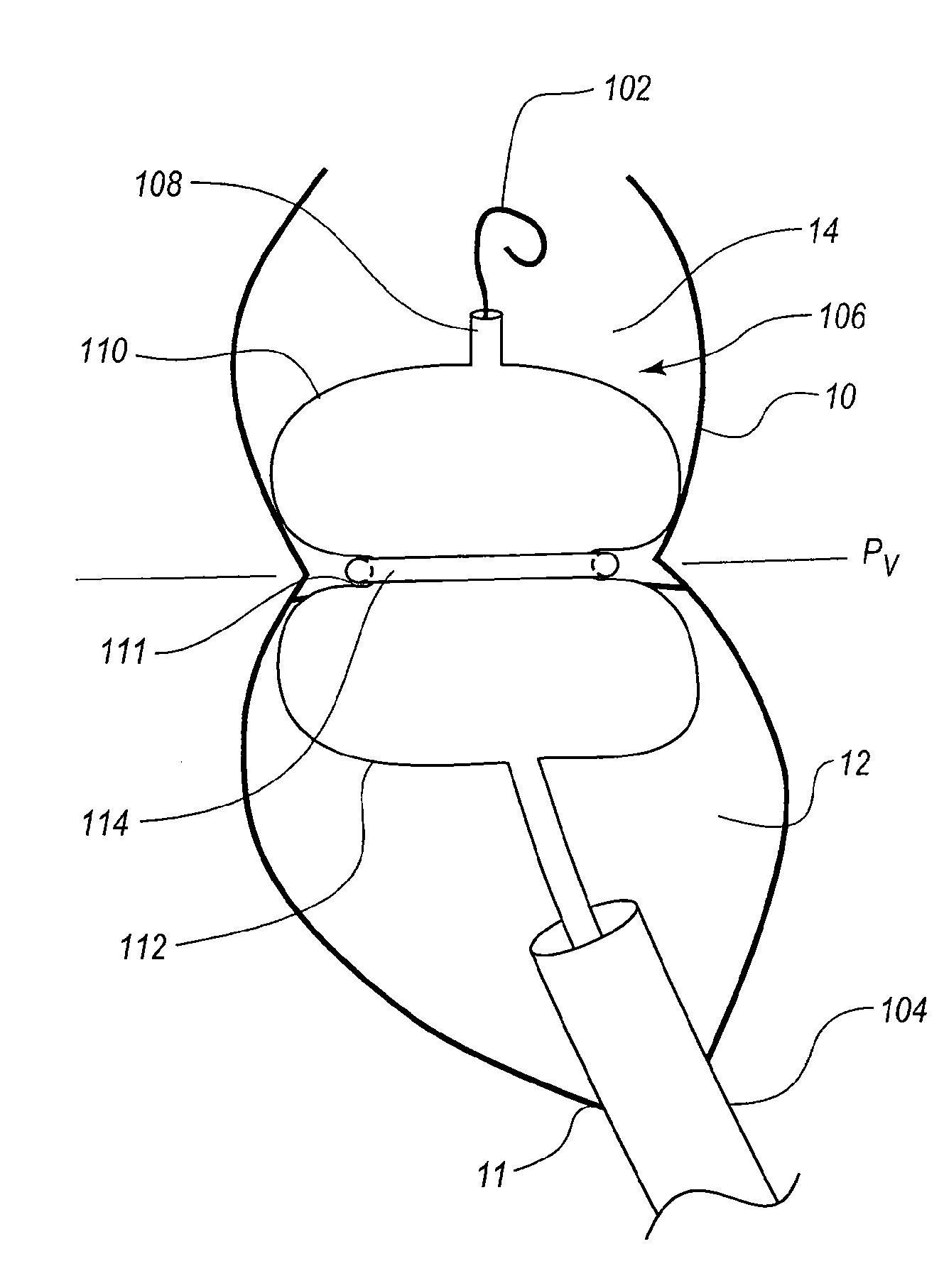 Percutaneous transcatheter repair of heart valves via trans-apical access