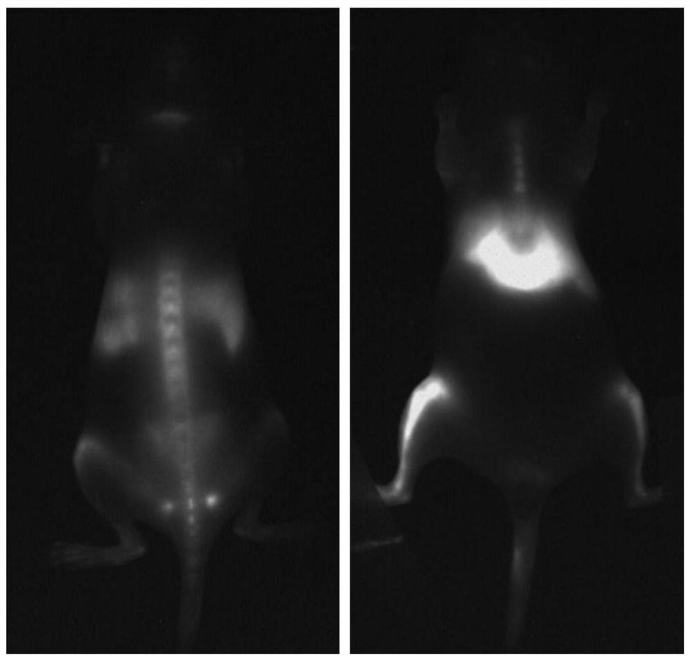 A bone-targeted drug delivery system based on near-infrared region II quantum dots and its preparation method and application