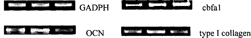 Novel use of ecdysterone