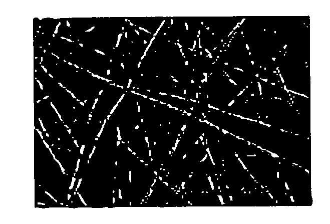 Aligned scaffolding system for skeletal muscle regeneration