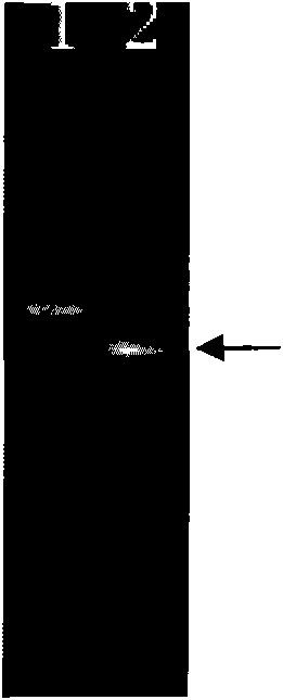 Monoacyl-diacyl lipase, and coding gene and application thereof