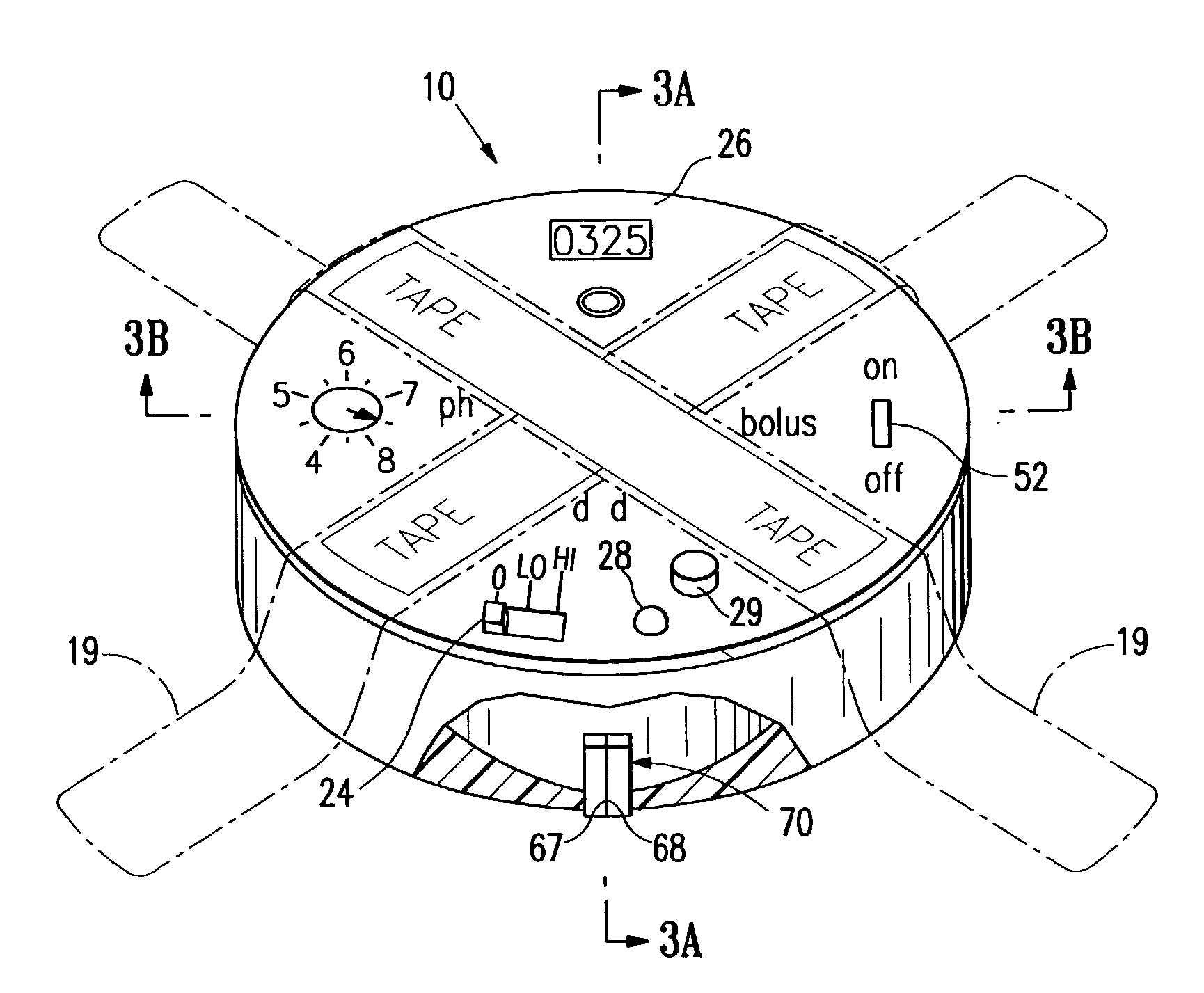 Sensor controlled analysis and therapeutic delivery system