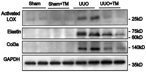 Application of ammonium tetrathiomolybdate in preparation of medicine used for treating renal interstitial fibrosis