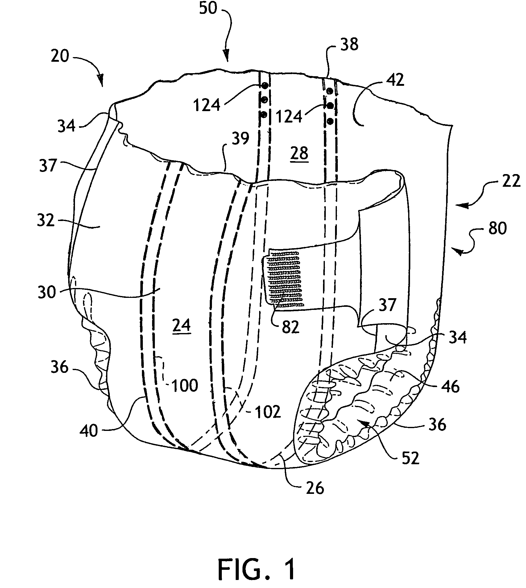 Absorbent articles with external access to internal conductors