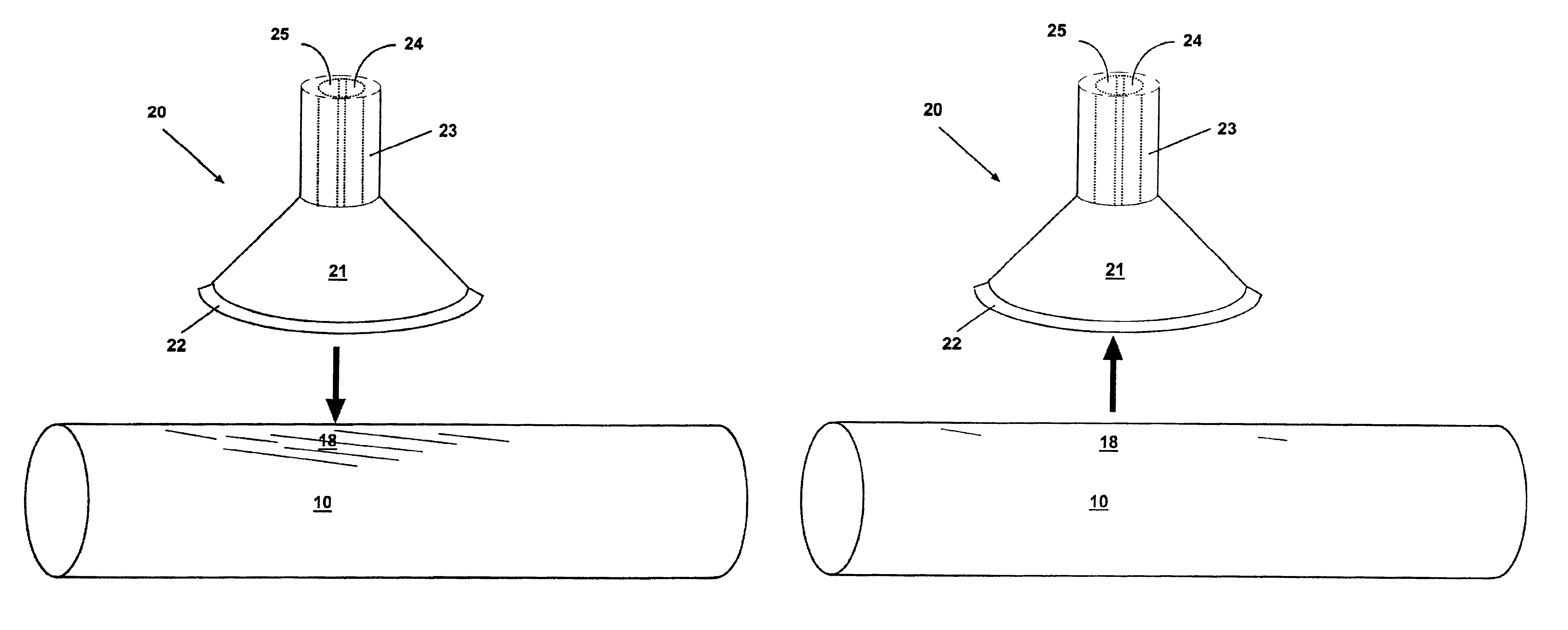 Methods and devices for reducing the mineral content of a region of non-intimal vascular tissue