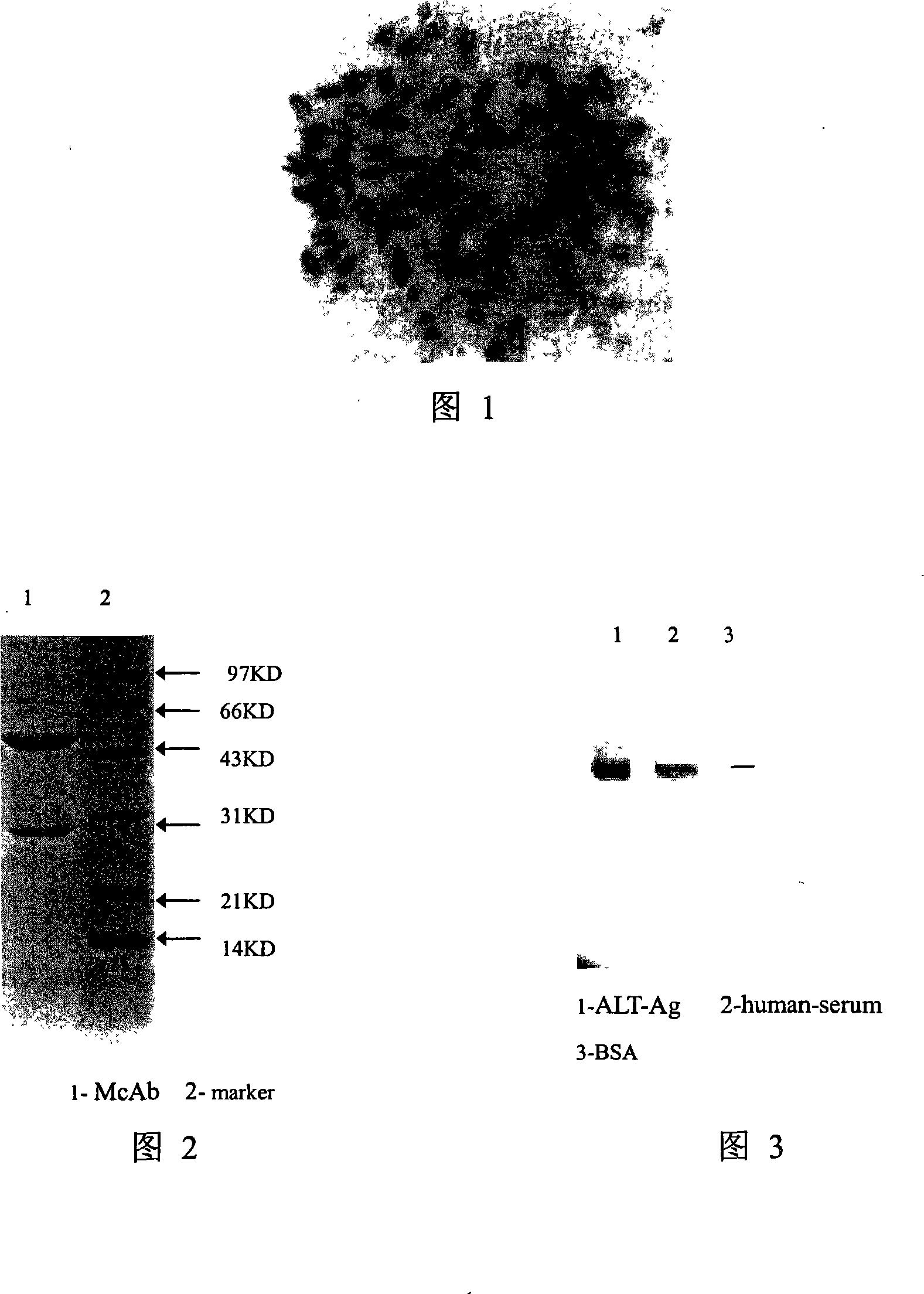 Alanine aminopherase monoclonal antibody and use thereof