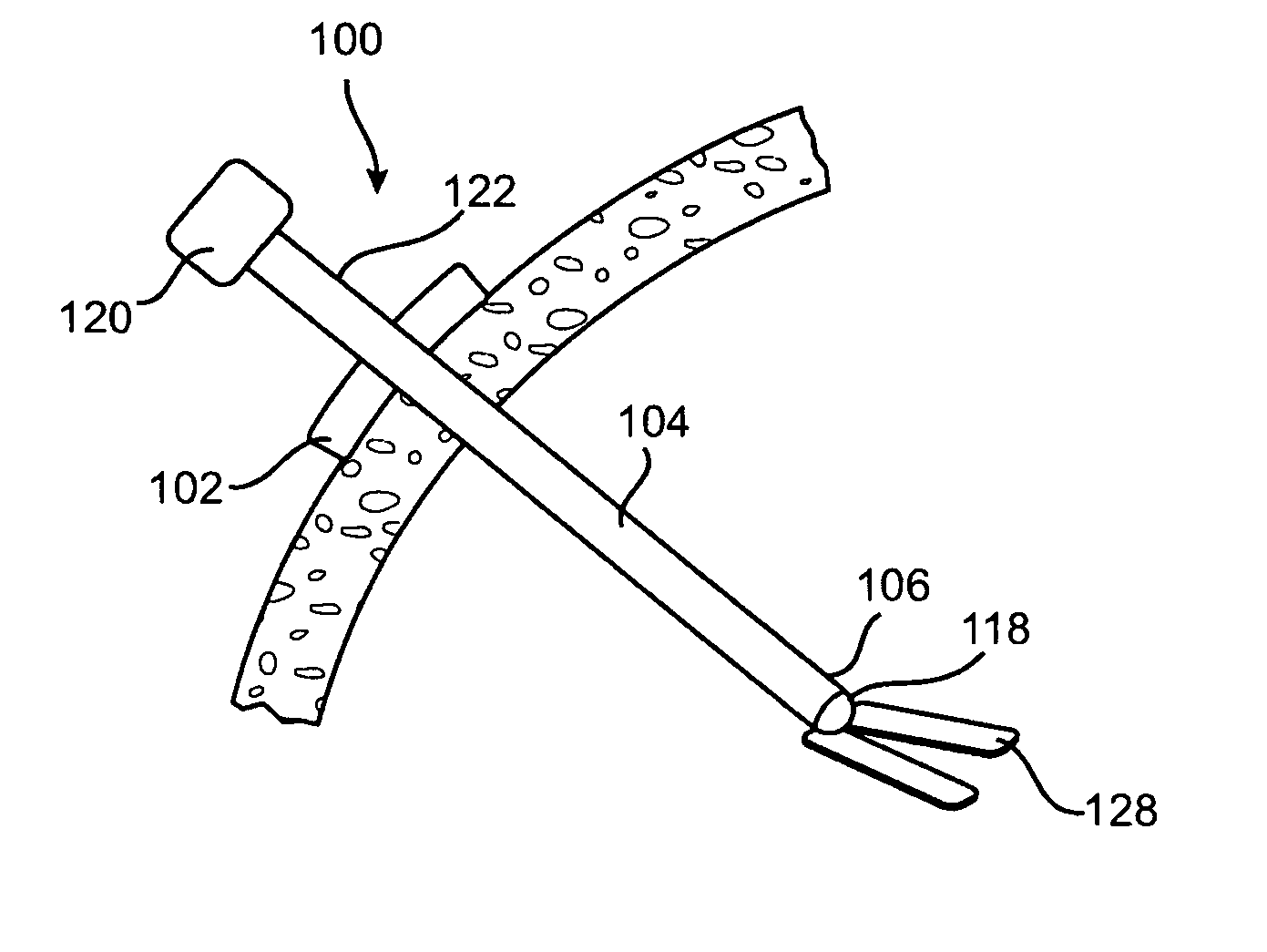 Thorax mounted stabilization platform