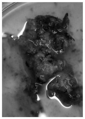 Human hepatocellular carcinoma cell strain and application thereof