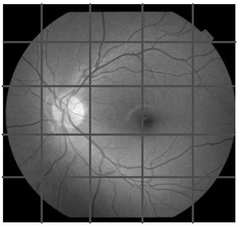 Lesion segmentation method, device and storage medium