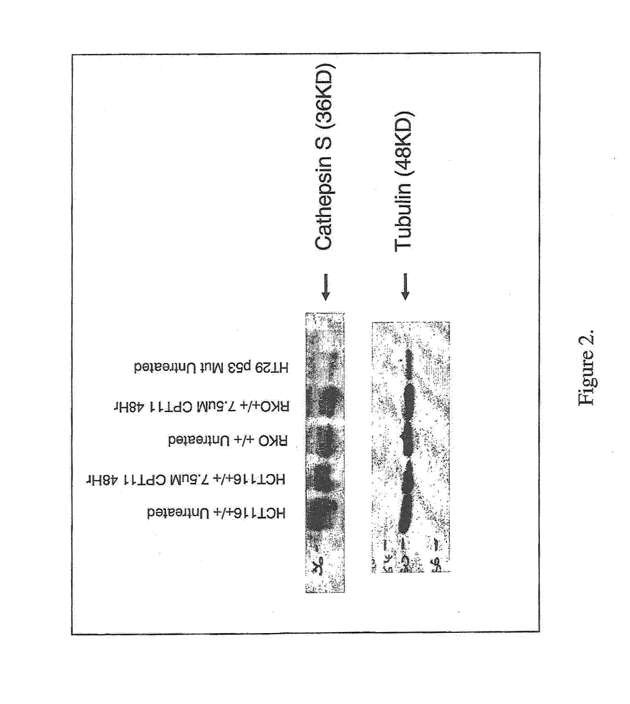 Therapy targeting cathepsin S