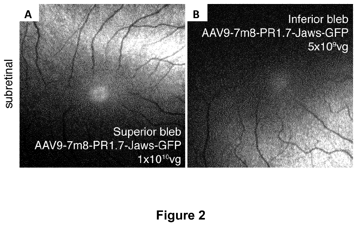 Methods of expressing a polynucleotide of interest in the cone photoreceptors of a subject comprising the subretinal delivery of a therapeutically effective amount of a recombinant aav9-derived vector