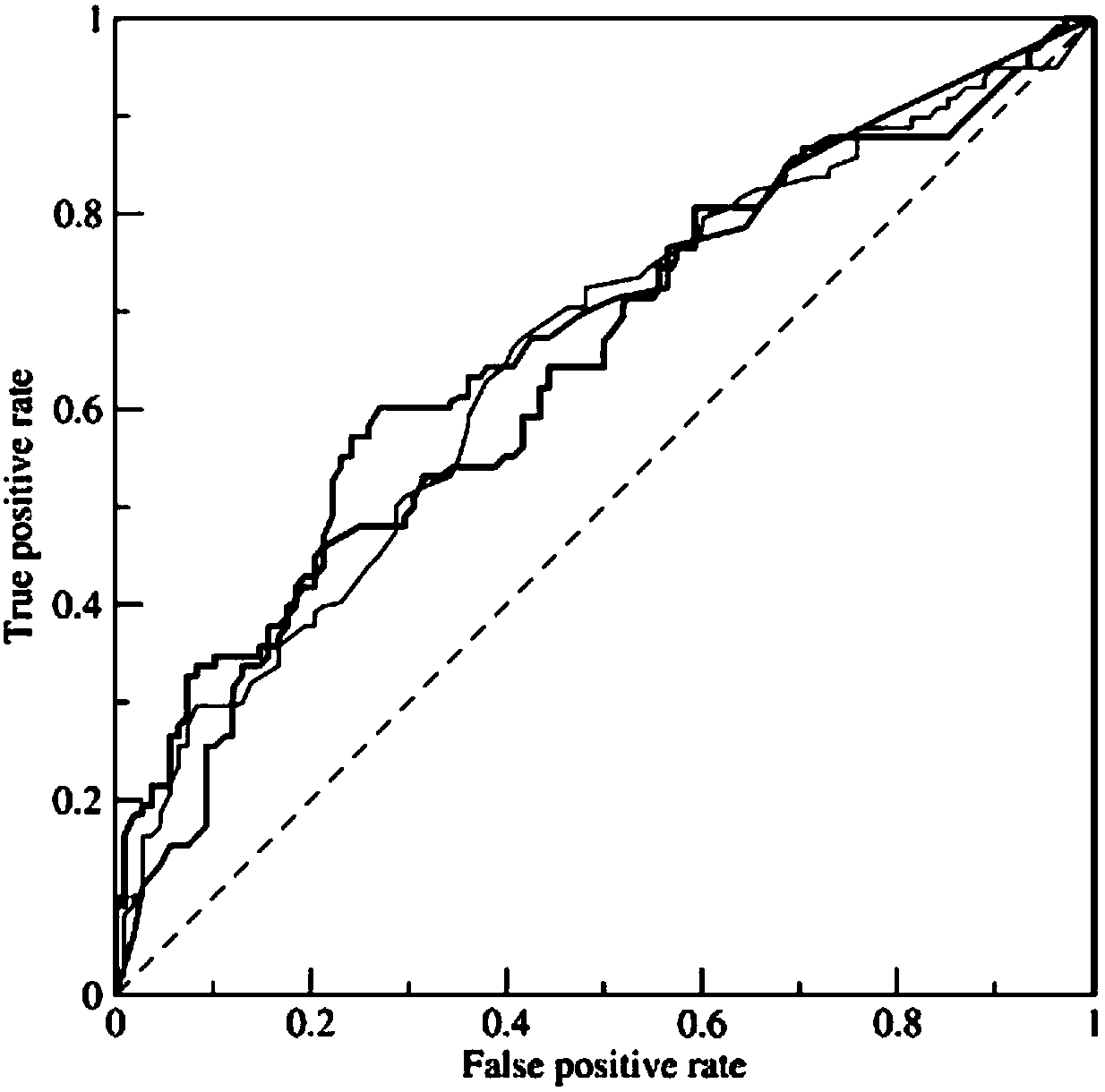 Stochastic subspace integrated learning based aortic dissection screening model and establishment method, system and model thereof