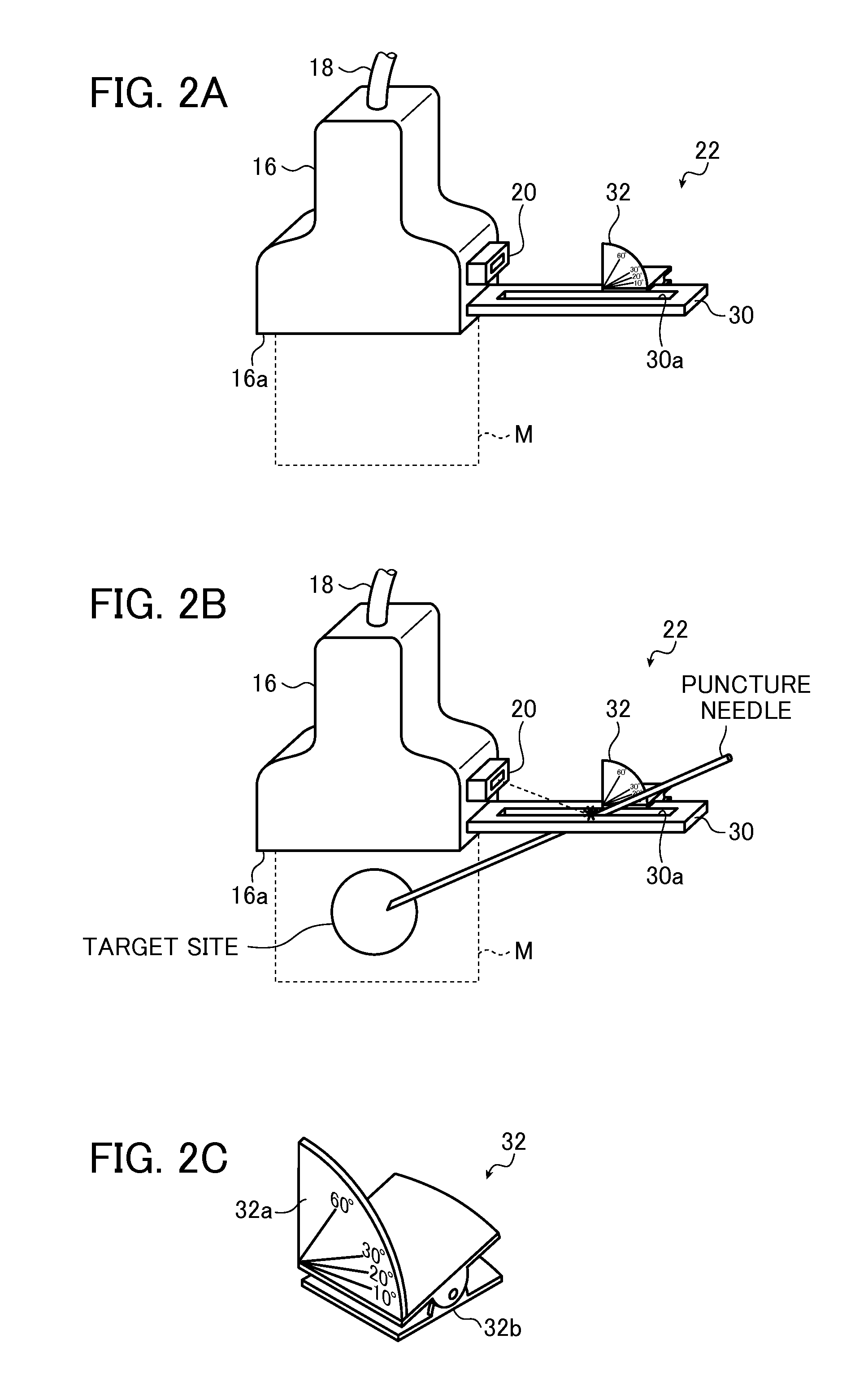 Ultrasound diagnostic apparatus