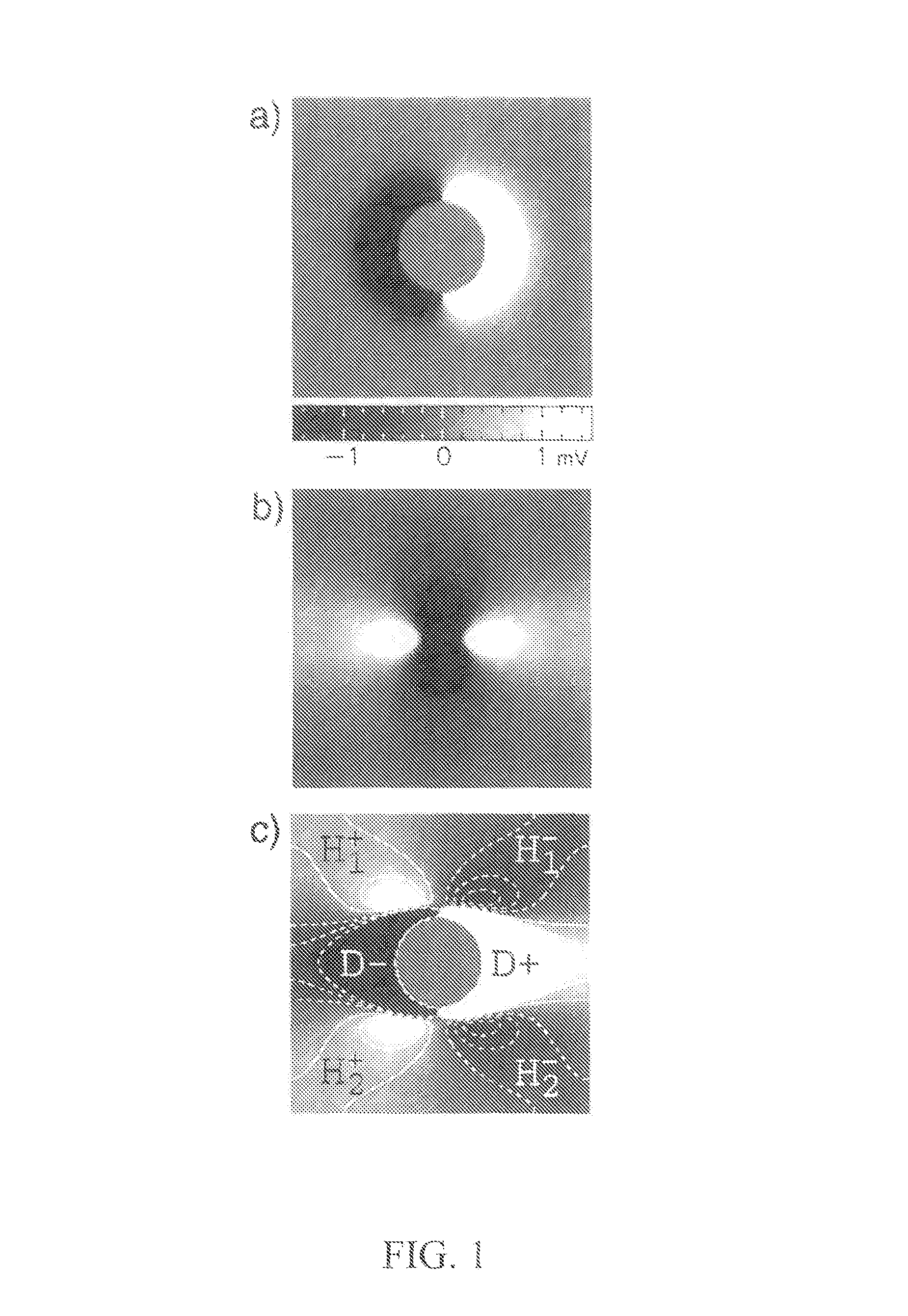 Method for low-voltage termination of cardiac arrhythmias by effectively unpinning anatomical reentries