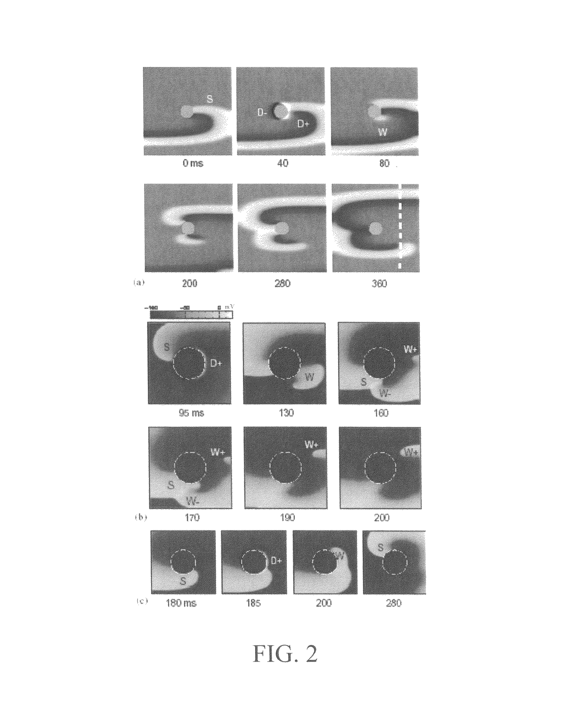 Method for low-voltage termination of cardiac arrhythmias by effectively unpinning anatomical reentries