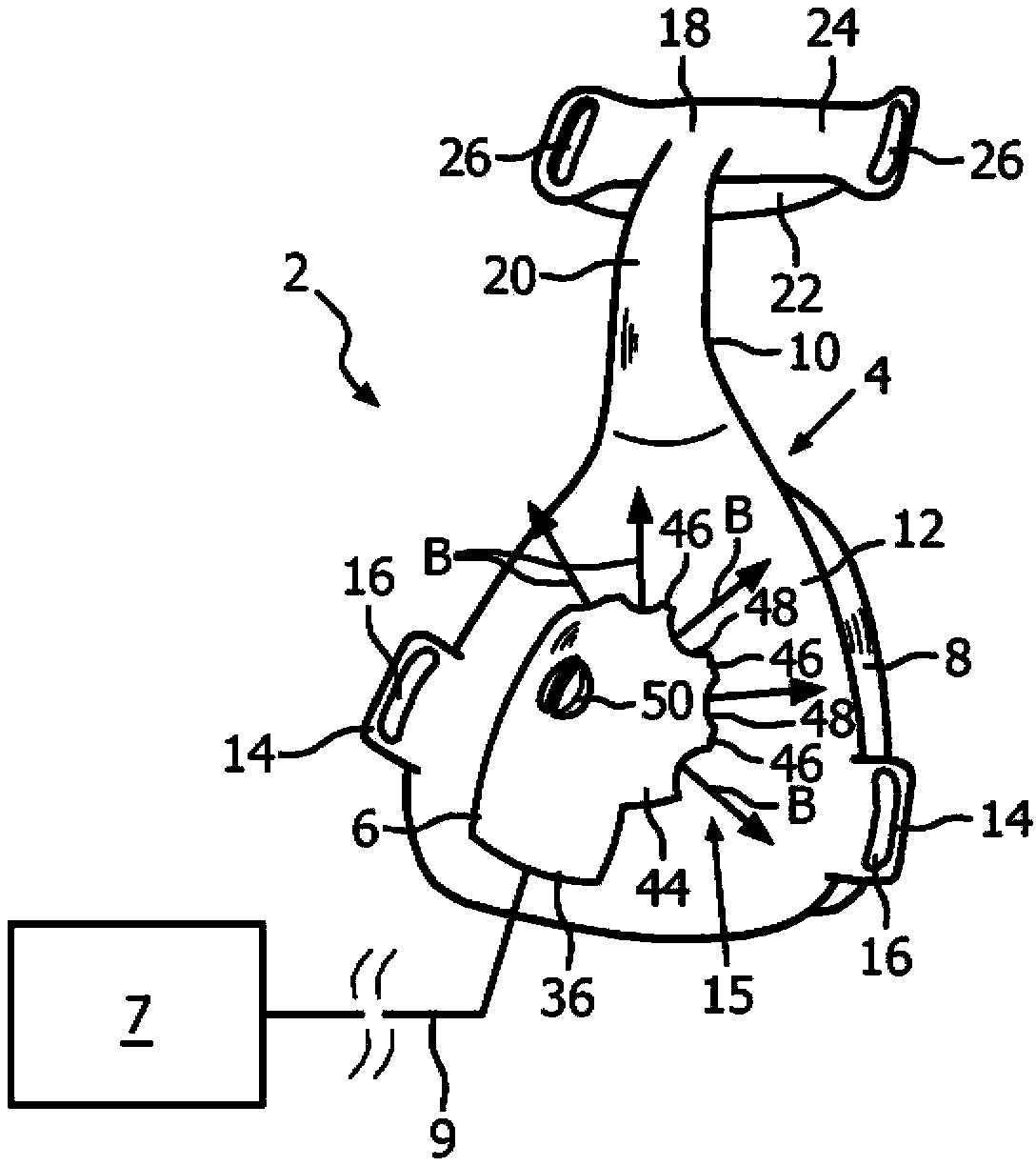 Exhaust gas assembly for a patient interface device