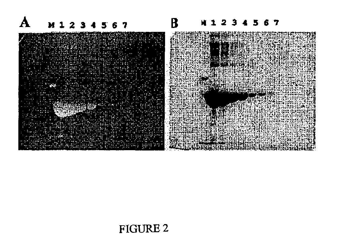 Fluorescent detection of proteins in polyacrylamide gels