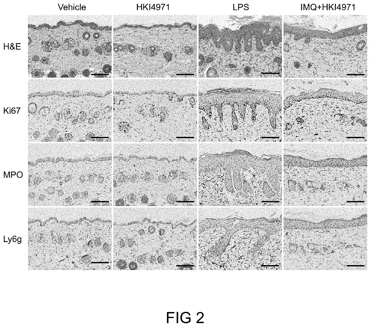 Neutrophil inflammation inhibitor and uses thereof