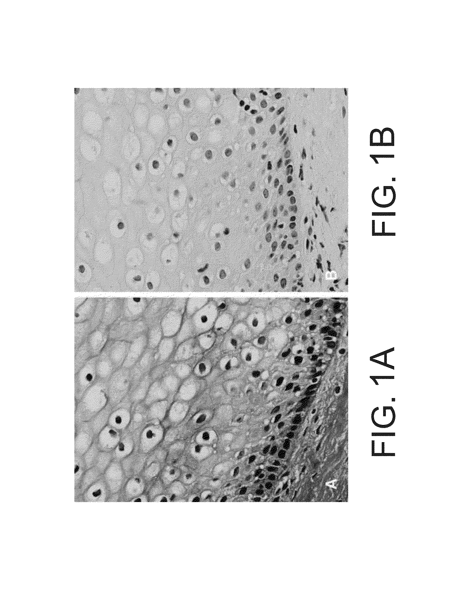 Kits for and methods of differential staining of cervical cancer cells and/or tissues