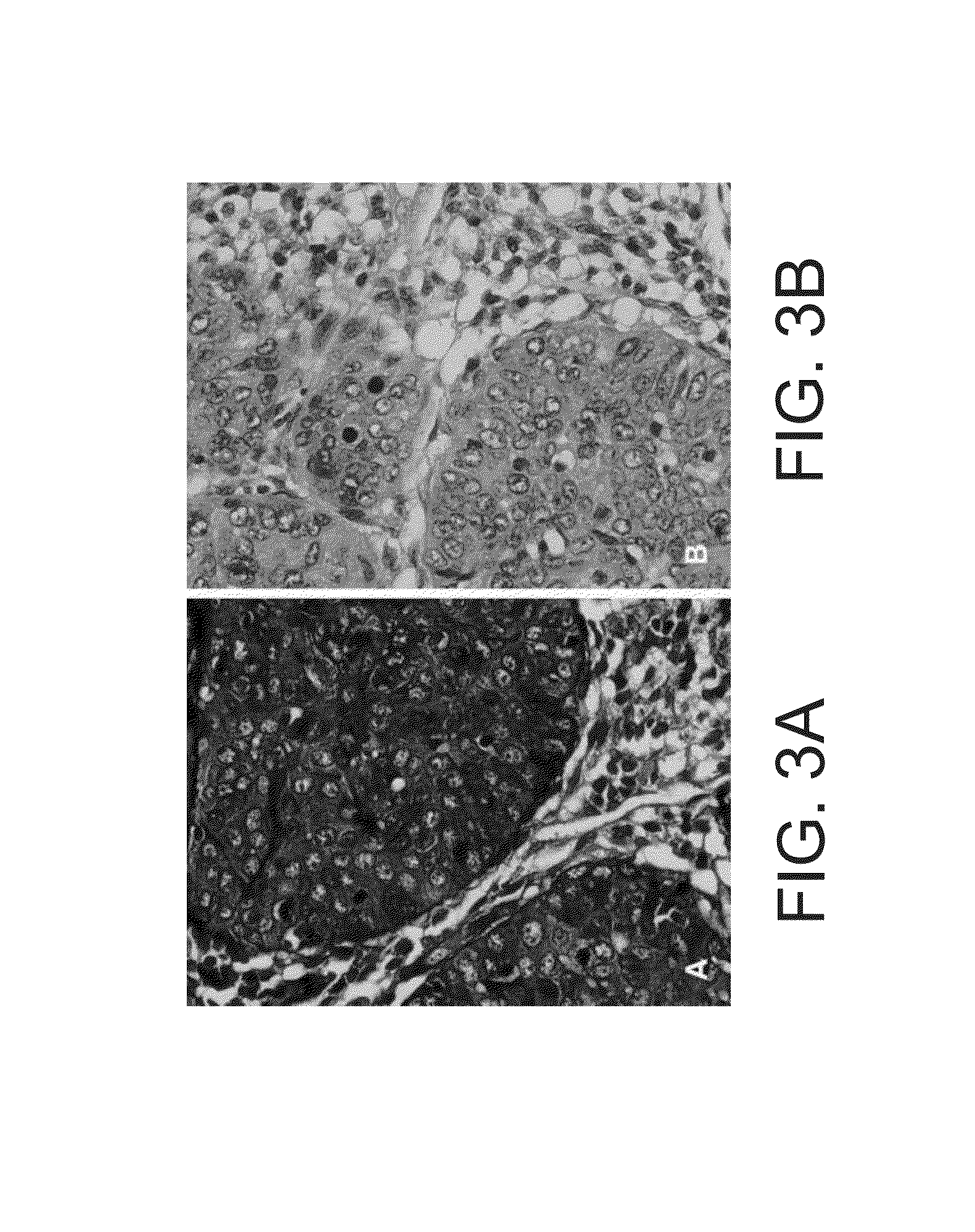 Kits for and methods of differential staining of cervical cancer cells and/or tissues