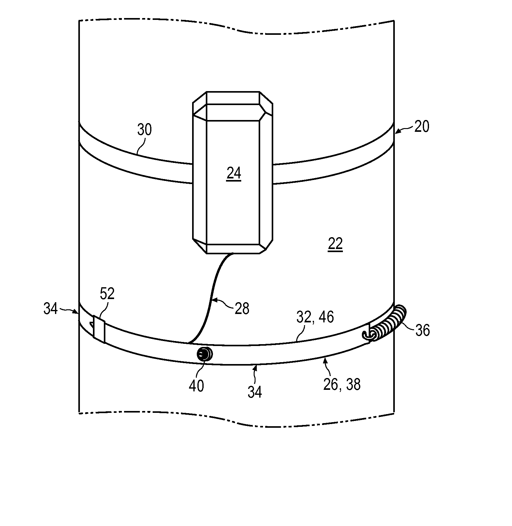 dendrometer