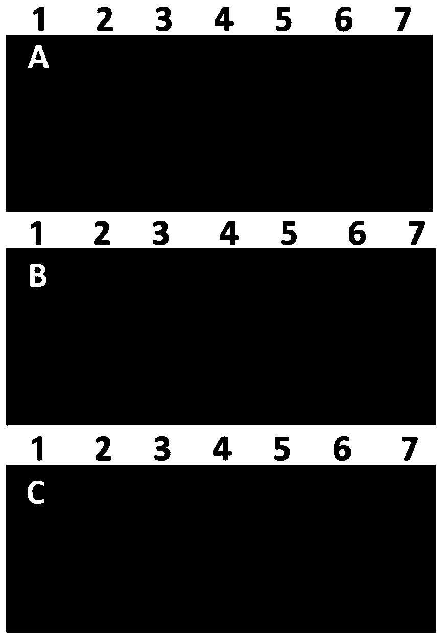 Primer composition, kit and method for detecting vesicular stomatitis Indiana viruses and vesicular stomatitis New Jersey viruses