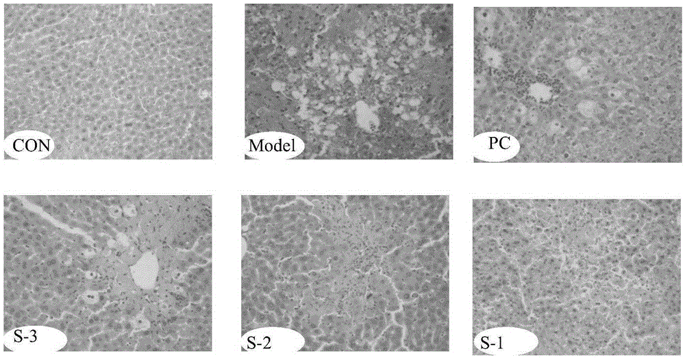 A kind of soft capsule containing milk thistle extract and preparation method thereof