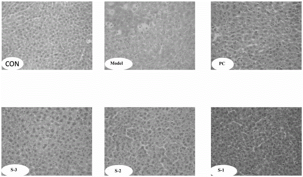 A kind of soft capsule containing milk thistle extract and preparation method thereof