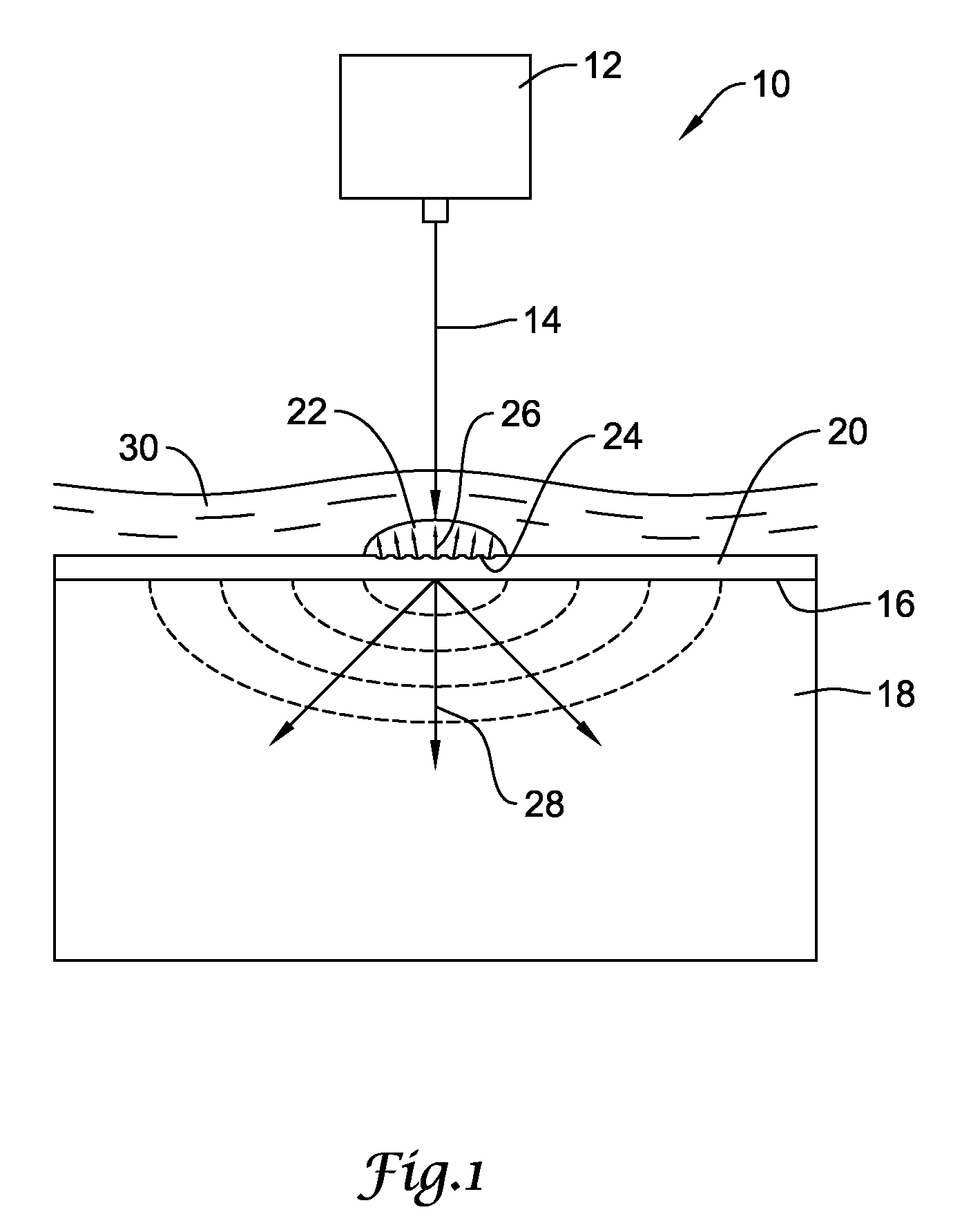 Laser shock peening of medical devices