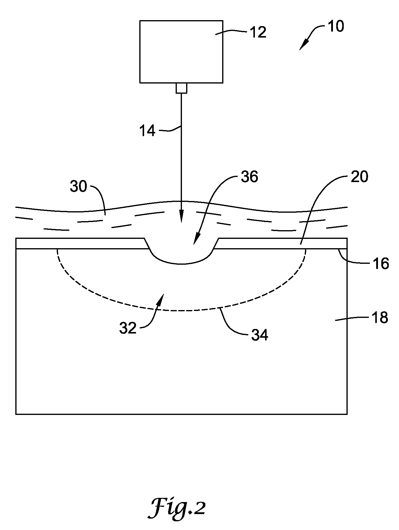 Laser shock peening of medical devices