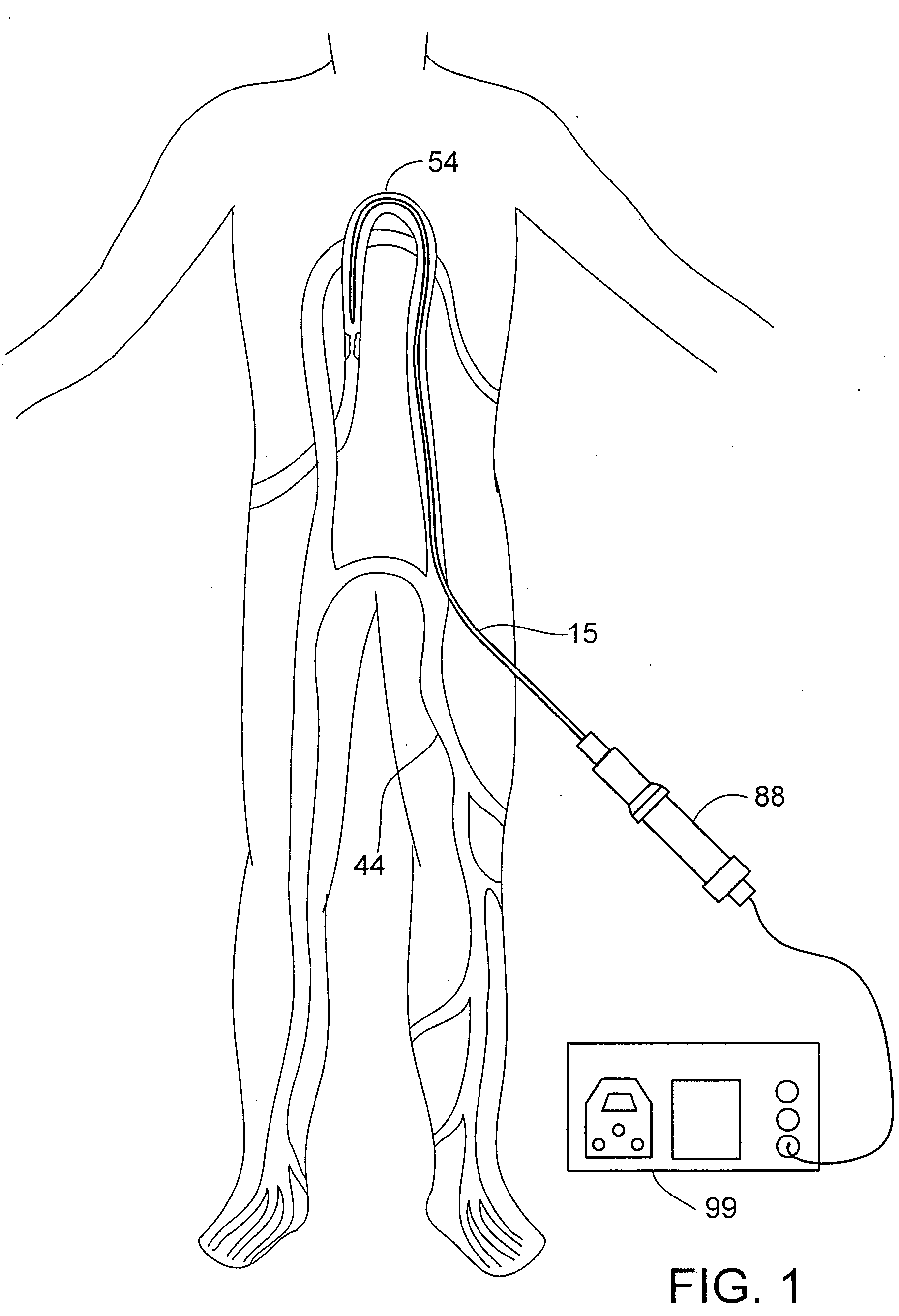 Apparatus and method for an ultrasonic medical device with variable frequency drive