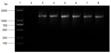 3-ketoacyl coenzyme A thiolase gene RKACAA1-2 and application thereof