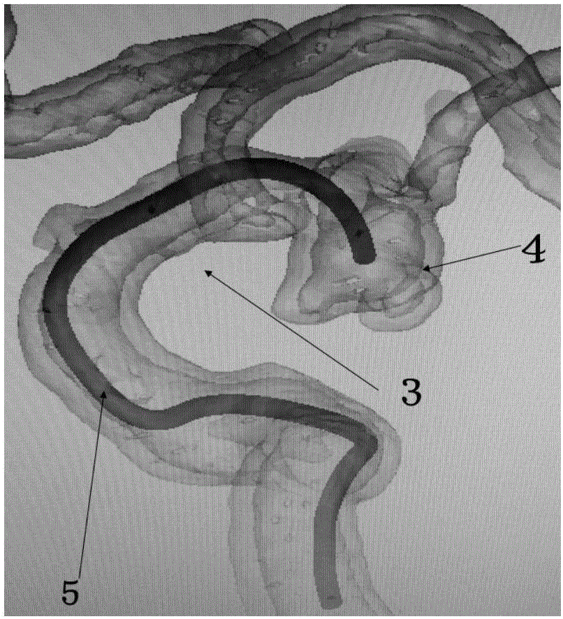 Microcatheter moulding stent used for intracranial aneurysm embolization and preparation method of microcatheter moulding stent