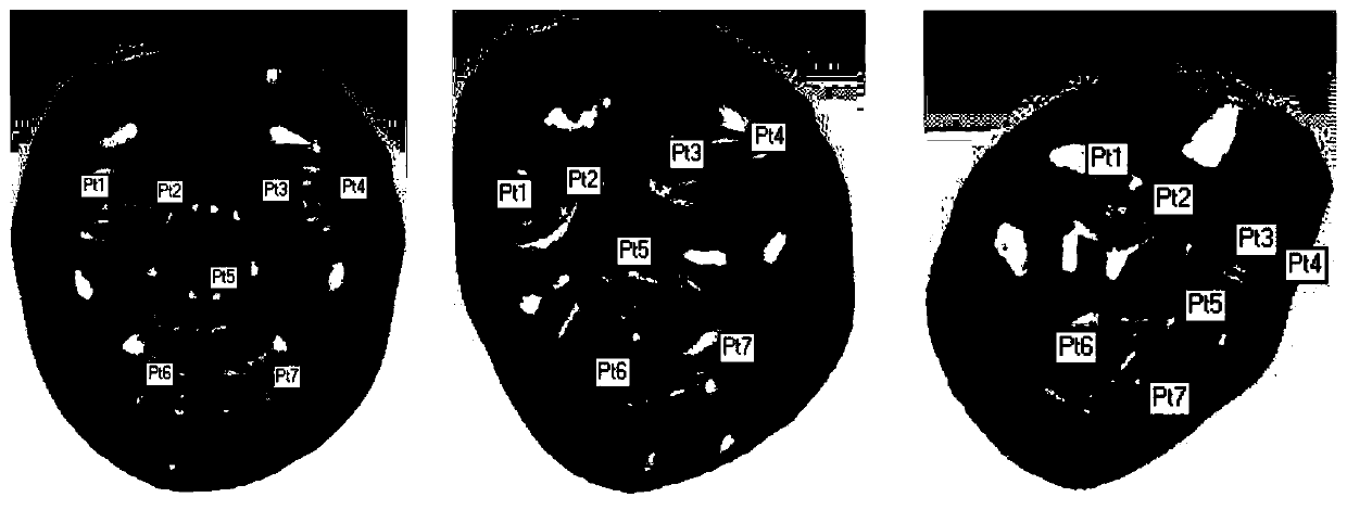 Acquisition method and detection method of living body face detection head posture regression device