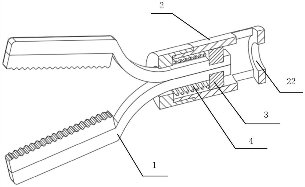 Hemostatic clip