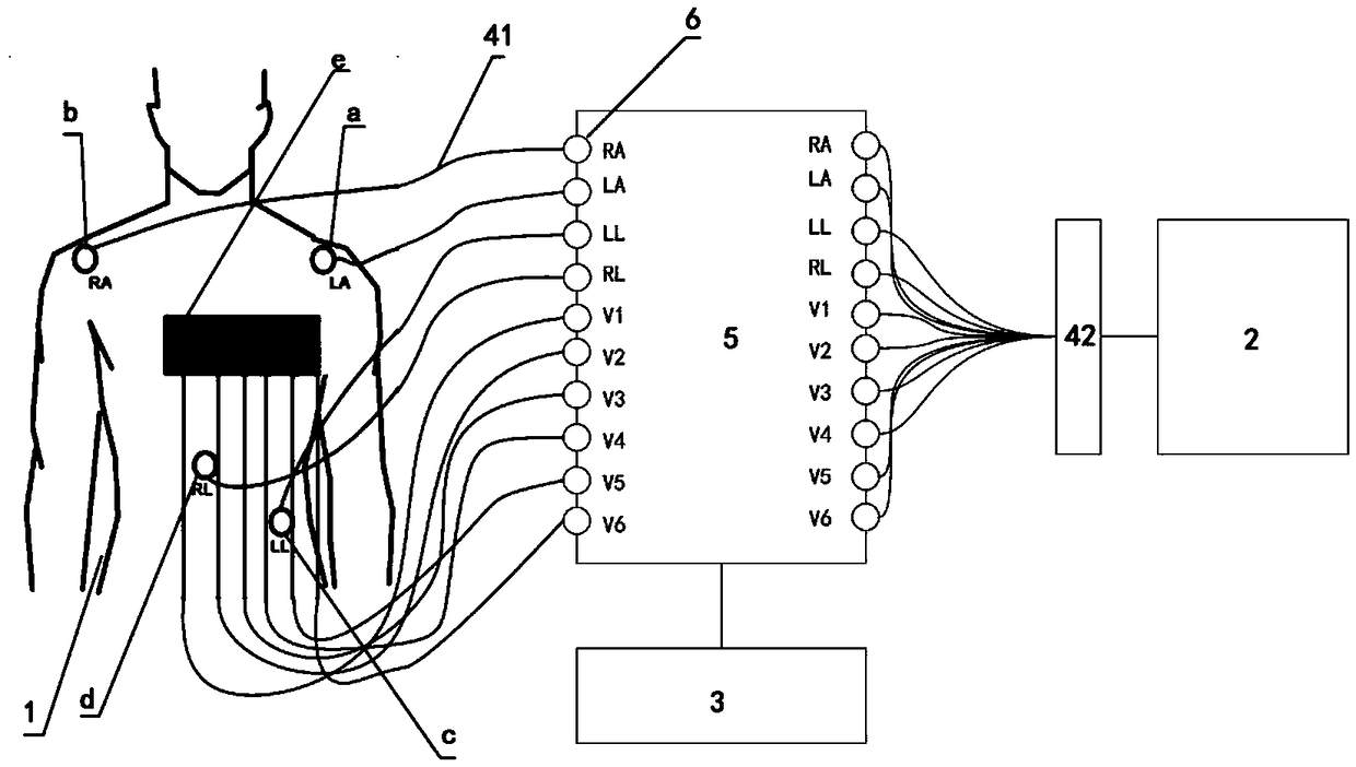 Electrocardiogram monitoring system and method