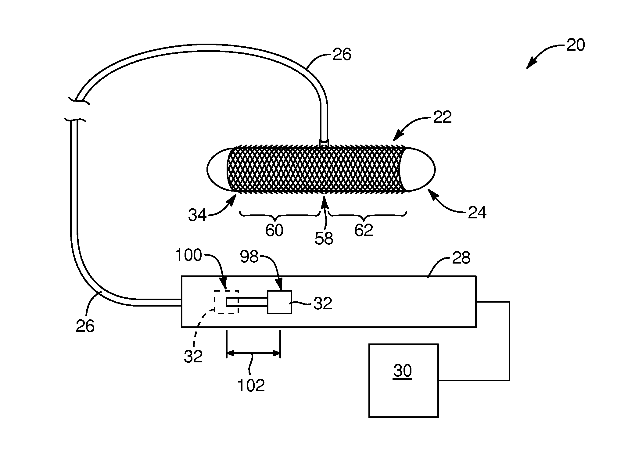 Open surgery anastomosis device, system, and method